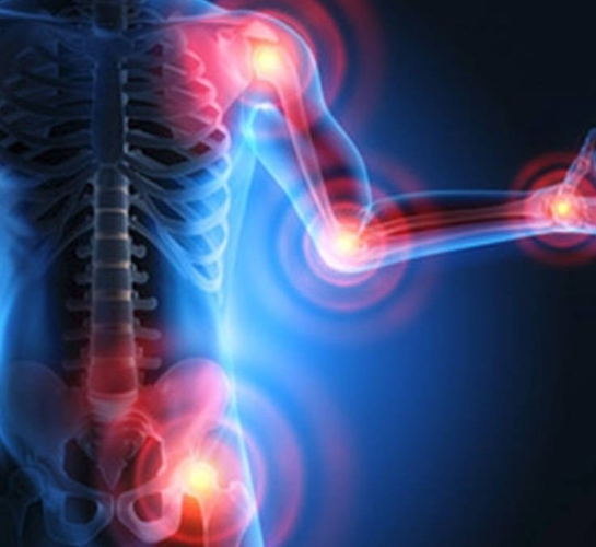 trastornos musculoesqueléticos 2
                